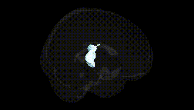 Full Brain Black